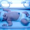 دستگاه زرد نوزاد آی ریمید