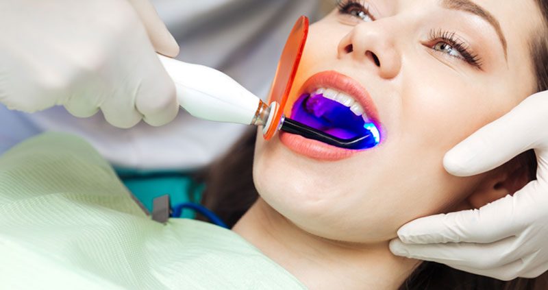 اشعه آبی دندانپزشکی آی ریمید