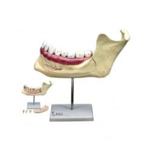مدل (مولاژ) آرواره پایینی